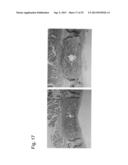 PHARMACEUTICAL COMPOSITION FOR TREATING BONE DISEASES WHICH COMPRISES     PROTEIN COMPRISING FRIZZLED1, FRIZZLED2 OR FRIZZLED7 EXTRACELLULAR     CYSTEINE-RICH DOMAIN diagram and image