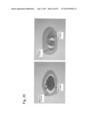 PHARMACEUTICAL COMPOSITION FOR TREATING BONE DISEASES WHICH COMPRISES     PROTEIN COMPRISING FRIZZLED1, FRIZZLED2 OR FRIZZLED7 EXTRACELLULAR     CYSTEINE-RICH DOMAIN diagram and image