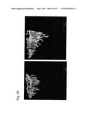 PHARMACEUTICAL COMPOSITION FOR TREATING BONE DISEASES WHICH COMPRISES     PROTEIN COMPRISING FRIZZLED1, FRIZZLED2 OR FRIZZLED7 EXTRACELLULAR     CYSTEINE-RICH DOMAIN diagram and image