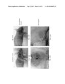 ISOLATED MESENCHYMAL PROGENITOR CELLS AND EXTRACELLULAR MATRIX PRODUCED     THEREBY diagram and image