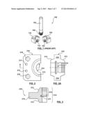 SPLIT THREAD INSERT diagram and image