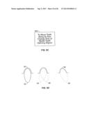 METHOD AND SYSTEM FOR OPTIMIZING DENTAL ALIGNER GEOMETRY diagram and image