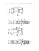 HOLDING DEVICE FOR DENTAL IMPLANT diagram and image