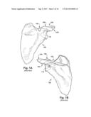 SYSTEM OF PREOPERATIVE PLANNING AND PROVISION OF PATIENT-SPECIFIC SURGICAL     AIDS diagram and image