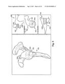 SYSTEM OF PREOPERATIVE PLANNING AND PROVISION OF PATIENT-SPECIFIC SURGICAL     AIDS diagram and image