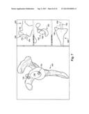 SYSTEM OF PREOPERATIVE PLANNING AND PROVISION OF PATIENT-SPECIFIC SURGICAL     AIDS diagram and image