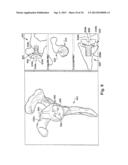 SYSTEM OF PREOPERATIVE PLANNING AND PROVISION OF PATIENT-SPECIFIC SURGICAL     AIDS diagram and image