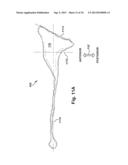 SYSTEM OF PREOPERATIVE PLANNING AND PROVISION OF PATIENT-SPECIFIC SURGICAL     AIDS diagram and image