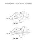 SYSTEM OF PREOPERATIVE PLANNING AND PROVISION OF PATIENT-SPECIFIC SURGICAL     AIDS diagram and image