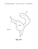 SYSTEM OF PREOPERATIVE PLANNING AND PROVISION OF PATIENT-SPECIFIC SURGICAL     AIDS diagram and image