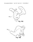 SYSTEM OF PREOPERATIVE PLANNING AND PROVISION OF PATIENT-SPECIFIC SURGICAL     AIDS diagram and image