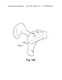 SYSTEM OF PREOPERATIVE PLANNING AND PROVISION OF PATIENT-SPECIFIC SURGICAL     AIDS diagram and image