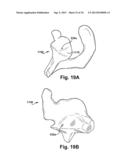 SYSTEM OF PREOPERATIVE PLANNING AND PROVISION OF PATIENT-SPECIFIC SURGICAL     AIDS diagram and image