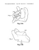 SYSTEM OF PREOPERATIVE PLANNING AND PROVISION OF PATIENT-SPECIFIC SURGICAL     AIDS diagram and image