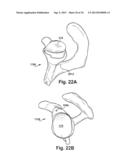 SYSTEM OF PREOPERATIVE PLANNING AND PROVISION OF PATIENT-SPECIFIC SURGICAL     AIDS diagram and image