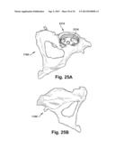 SYSTEM OF PREOPERATIVE PLANNING AND PROVISION OF PATIENT-SPECIFIC SURGICAL     AIDS diagram and image