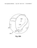 SYSTEM OF PREOPERATIVE PLANNING AND PROVISION OF PATIENT-SPECIFIC SURGICAL     AIDS diagram and image