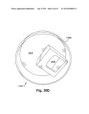 SYSTEM OF PREOPERATIVE PLANNING AND PROVISION OF PATIENT-SPECIFIC SURGICAL     AIDS diagram and image