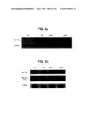 PROTEIN KINASE CK2 GENE MUTATIONS, AMPLIFICATIONS AND POLYMORPHISMS IN     HUMAN CANCERS AND METHODS OF USE diagram and image