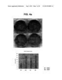 PROTEIN KINASE CK2 GENE MUTATIONS, AMPLIFICATIONS AND POLYMORPHISMS IN     HUMAN CANCERS AND METHODS OF USE diagram and image