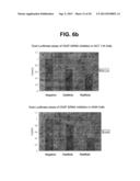 PROTEIN KINASE CK2 GENE MUTATIONS, AMPLIFICATIONS AND POLYMORPHISMS IN     HUMAN CANCERS AND METHODS OF USE diagram and image