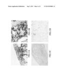 METHOD FOR DETECTION OF IDIOPATHIC INTERSTITIAL PNEUMONIA diagram and image