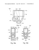 TREATMENT OF A SAMPLE WITH FOCUSED ACOUSTIC ENERGY diagram and image