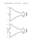 INFLATABLE DEVICE CAPABLE OF GLIDING, IN PARTICULAR OVER WATER diagram and image