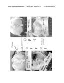METHODS OF TREATING CARTILAGE DEFECTS diagram and image