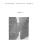 METHODS OF TREATING CARTILAGE DEFECTS diagram and image