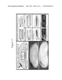 METHODS OF TREATING CARTILAGE DEFECTS diagram and image