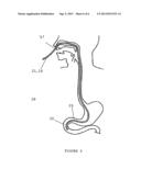 MEDICAL APPLICATIONS OF A MINIATURE VIDEOSCOPE diagram and image