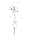 SURGICAL ACCESS SYSTEM AND RELATED METHODS diagram and image