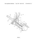 SURGICAL ACCESS SYSTEM AND RELATED METHODS diagram and image