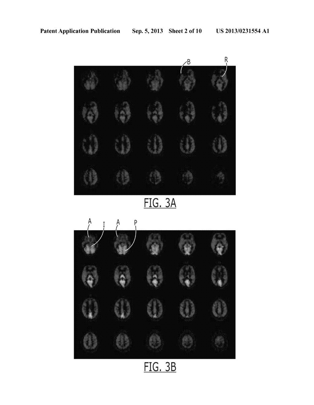 VESSEL ENCODED ARTERIAL SPIN LABELING USING FOURIER ENCODING SUITABLE FOR     VASCULAR TERRITORY MAPPING - diagram, schematic, and image 03