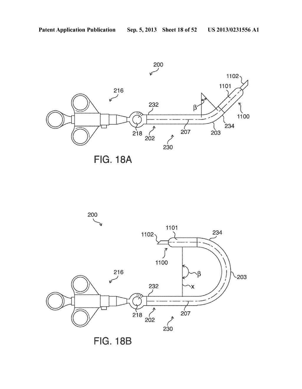 SYSTEMS, METHODS AND DEVICES FOR PLACING A LOCALIZATION ELEMENT IN AN     ORGAN OF A PATIENT FOR FOUR DIMENSIONAL SOFT TISSUE NAVIGATION - diagram, schematic, and image 19