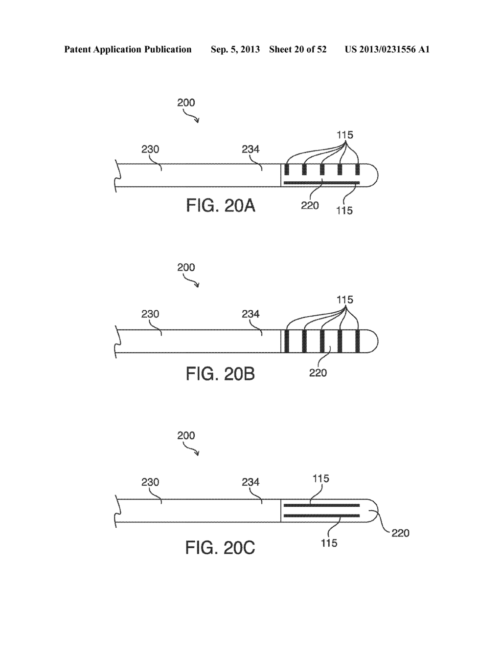 SYSTEMS, METHODS AND DEVICES FOR PLACING A LOCALIZATION ELEMENT IN AN     ORGAN OF A PATIENT FOR FOUR DIMENSIONAL SOFT TISSUE NAVIGATION - diagram, schematic, and image 21