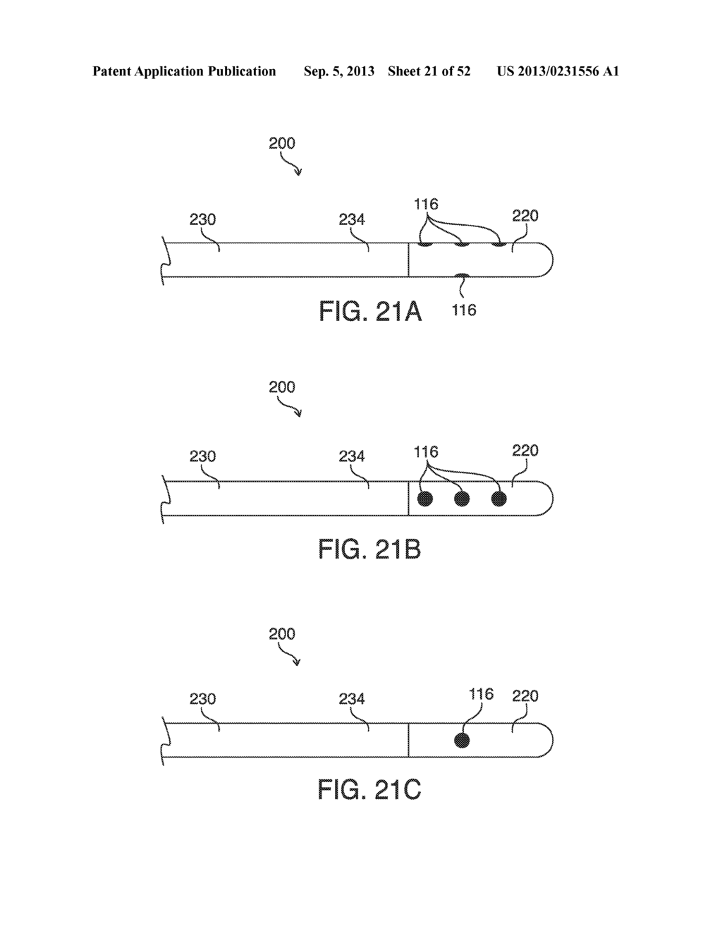 SYSTEMS, METHODS AND DEVICES FOR PLACING A LOCALIZATION ELEMENT IN AN     ORGAN OF A PATIENT FOR FOUR DIMENSIONAL SOFT TISSUE NAVIGATION - diagram, schematic, and image 22