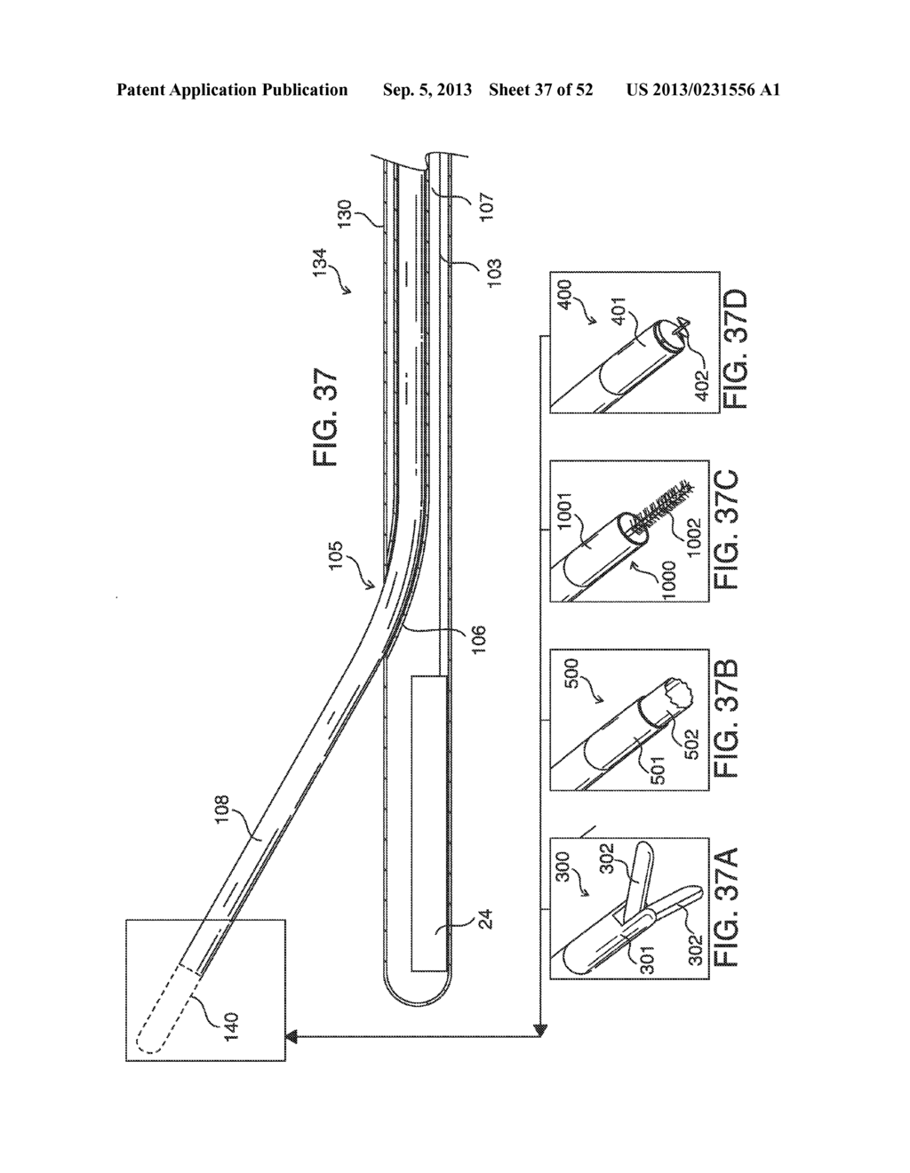 SYSTEMS, METHODS AND DEVICES FOR PLACING A LOCALIZATION ELEMENT IN AN     ORGAN OF A PATIENT FOR FOUR DIMENSIONAL SOFT TISSUE NAVIGATION - diagram, schematic, and image 38