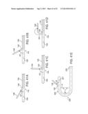 SYSTEMS, METHODS AND DEVICES FOR PLACING A LOCALIZATION ELEMENT IN AN     ORGAN OF A PATIENT FOR FOUR DIMENSIONAL SOFT TISSUE NAVIGATION diagram and image