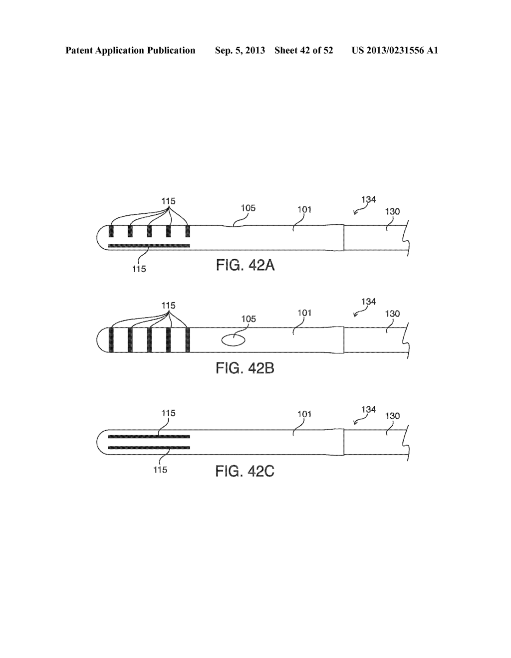 SYSTEMS, METHODS AND DEVICES FOR PLACING A LOCALIZATION ELEMENT IN AN     ORGAN OF A PATIENT FOR FOUR DIMENSIONAL SOFT TISSUE NAVIGATION - diagram, schematic, and image 43