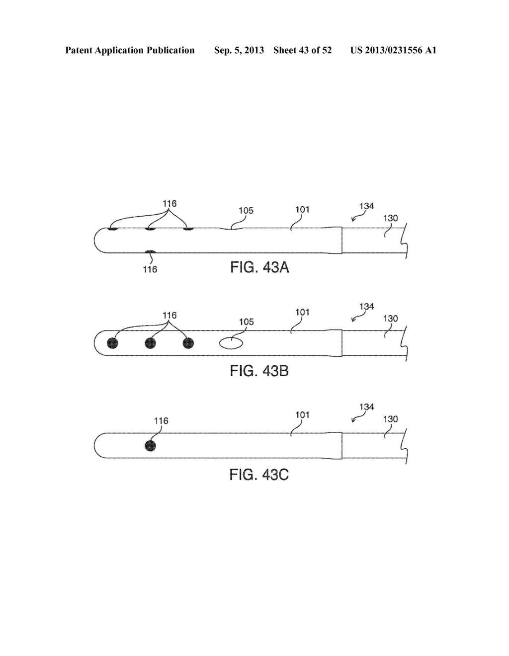 SYSTEMS, METHODS AND DEVICES FOR PLACING A LOCALIZATION ELEMENT IN AN     ORGAN OF A PATIENT FOR FOUR DIMENSIONAL SOFT TISSUE NAVIGATION - diagram, schematic, and image 44