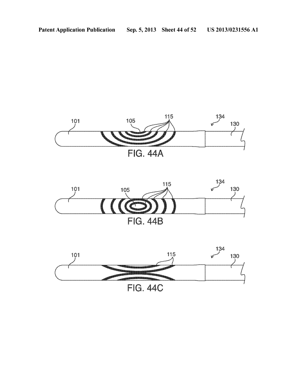 SYSTEMS, METHODS AND DEVICES FOR PLACING A LOCALIZATION ELEMENT IN AN     ORGAN OF A PATIENT FOR FOUR DIMENSIONAL SOFT TISSUE NAVIGATION - diagram, schematic, and image 45