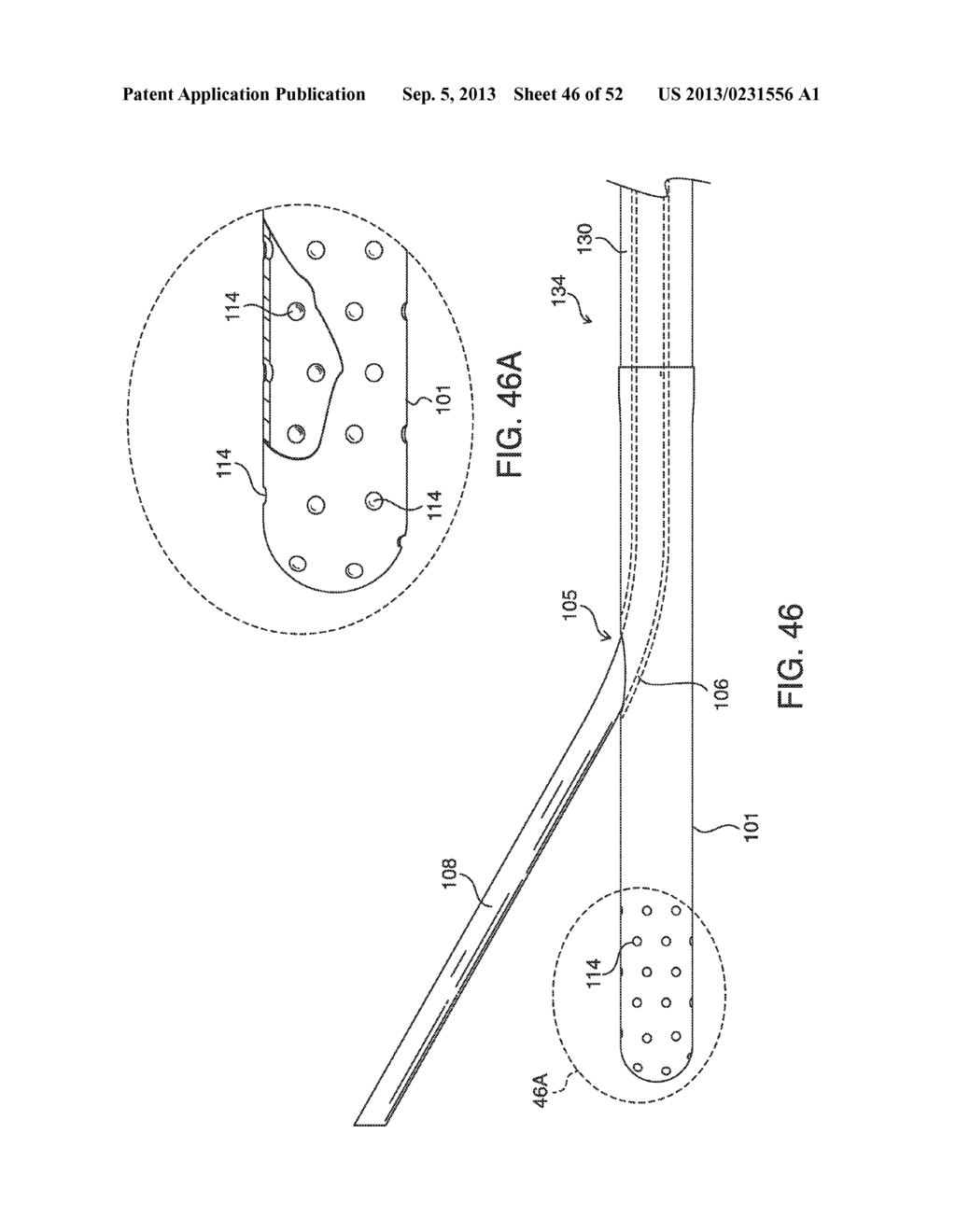 SYSTEMS, METHODS AND DEVICES FOR PLACING A LOCALIZATION ELEMENT IN AN     ORGAN OF A PATIENT FOR FOUR DIMENSIONAL SOFT TISSUE NAVIGATION - diagram, schematic, and image 47