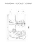 SYSTEM AND METHOD FOR ANALYZING GAIT AND RECOMMENDING FOOTWEAR WITH A     MOBILE COMPUTER DEVICE diagram and image