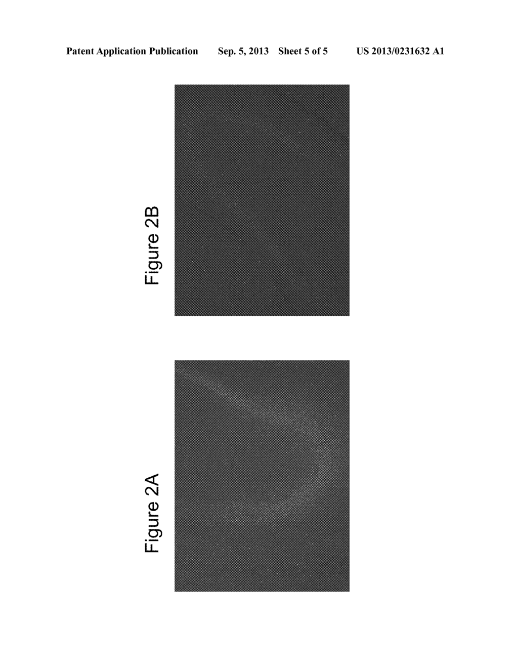 TREATMENT AND PREVENTION OF NEURODEGENERATIVE DISEASES USING GENE THERAPY - diagram, schematic, and image 06