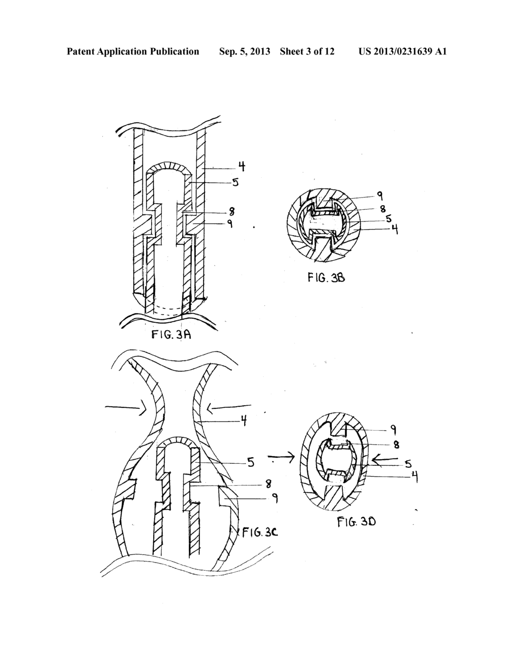 Drainage Catheter - diagram, schematic, and image 04