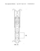 Drainage Catheter diagram and image