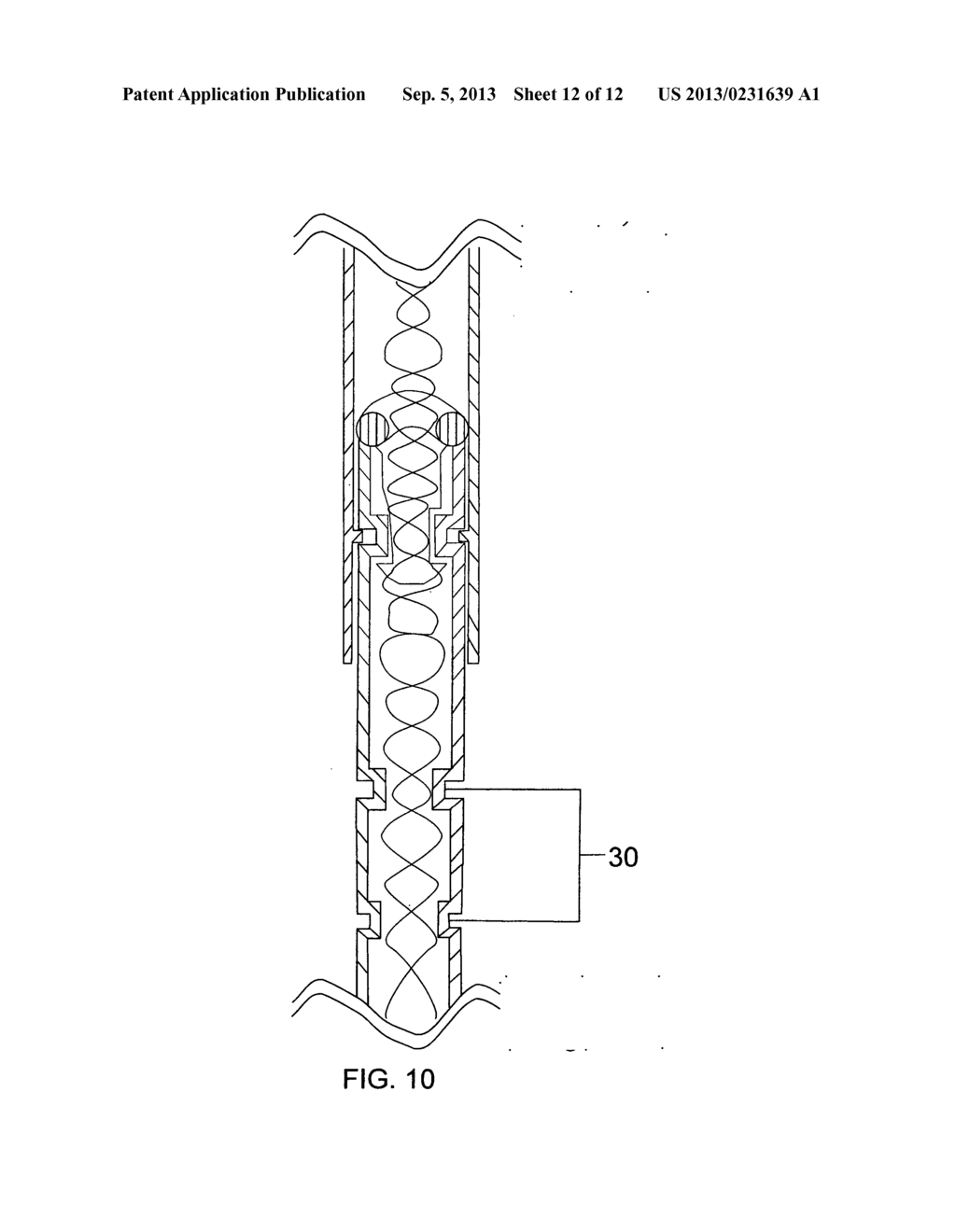 Drainage Catheter - diagram, schematic, and image 13