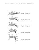 DISPOSABLE TIPS FOR LASER SYSTEMS AND RELATED METHODS diagram and image